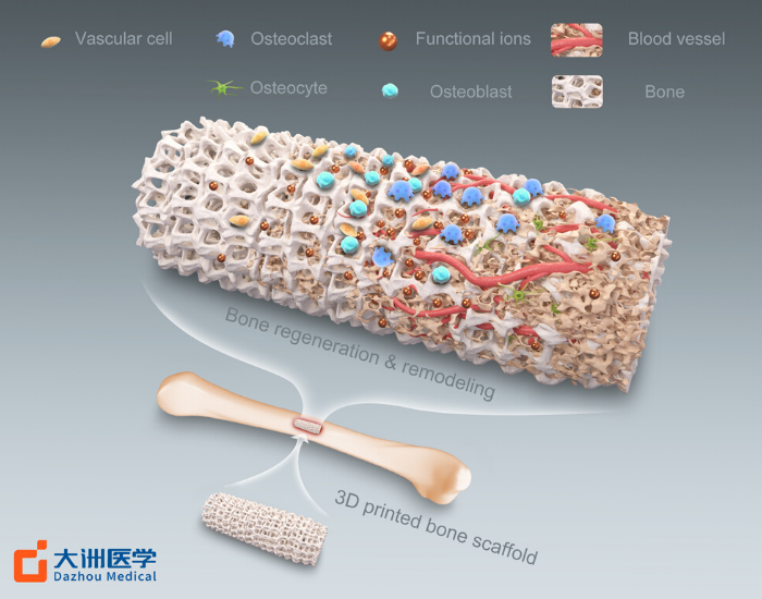 產品&解決方案-詳細大圖-人工骨.png